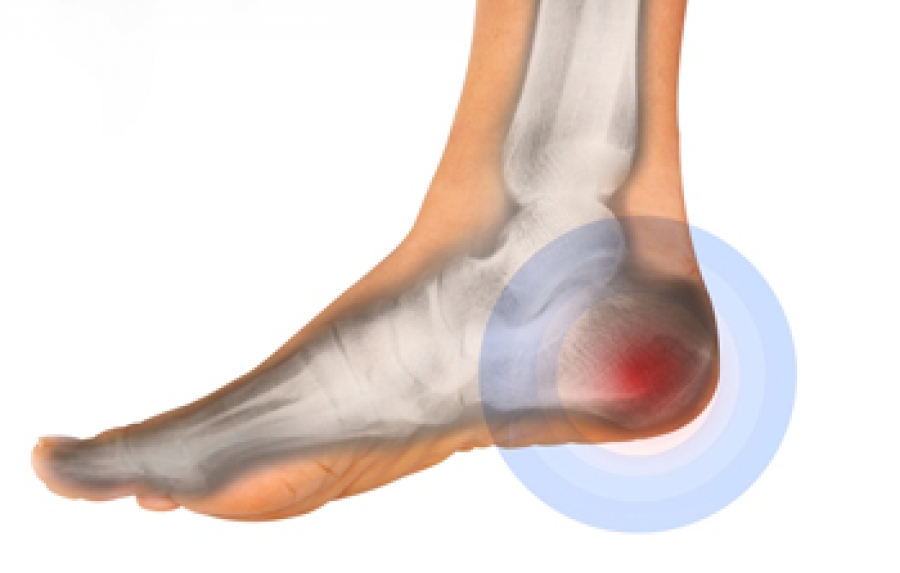 What To Expect During Your Wound Debridement: AllCare Foot & Ankle Center:  Podiatry
